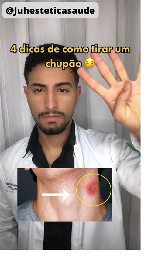 chupão no peito|3 Formas de Dar um Chupão em Alguém